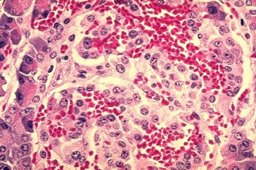 Histopatologia