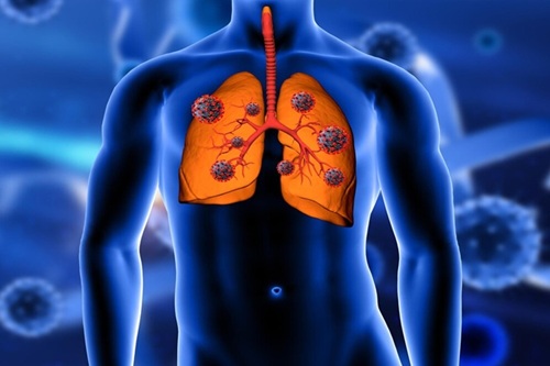 Doenças Respiratórias